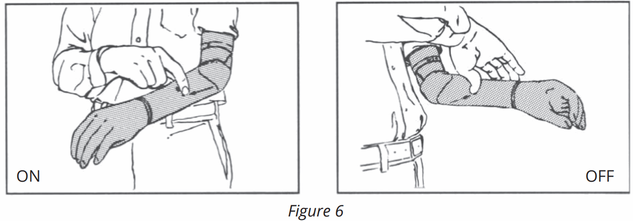 Fillauer Utah Arm U3 and U3 plus - Figure 6