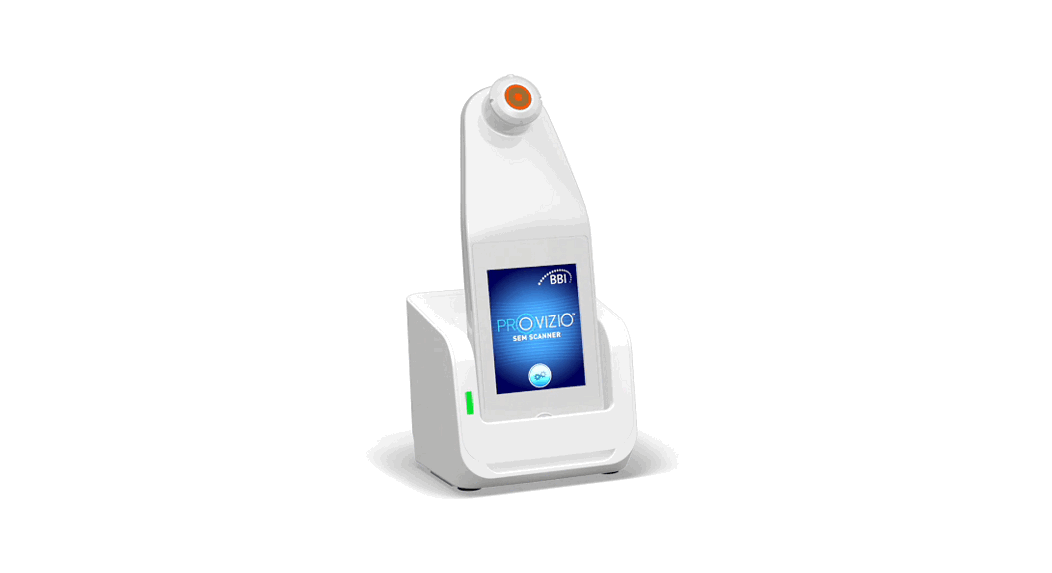 PROVIZIO SEM SCANNER Barcode Scanner - Featured Image