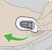 Dexcom G6 Pro Continuous Glucose Monitoring System-.icon26