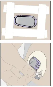 Dexcom G6 Pro Continuous Glucose Monitoring System-.icon28
