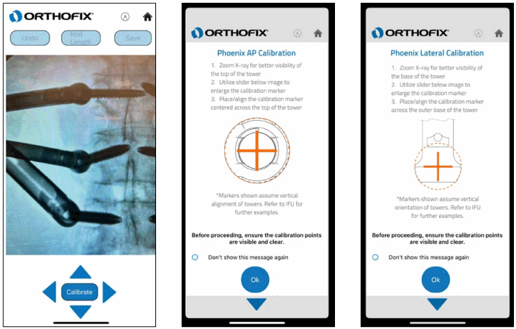 ORTHOFIX OFIX MIS App Workflow - Start Calibration