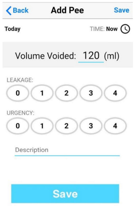 iUFLOW Galaxy S6 Perfect Bladder Tracking Uroflowmetry and Real Time Data - IUFLOW Uroflowmeter - Edit Session