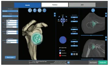 Blueprint scan protocol