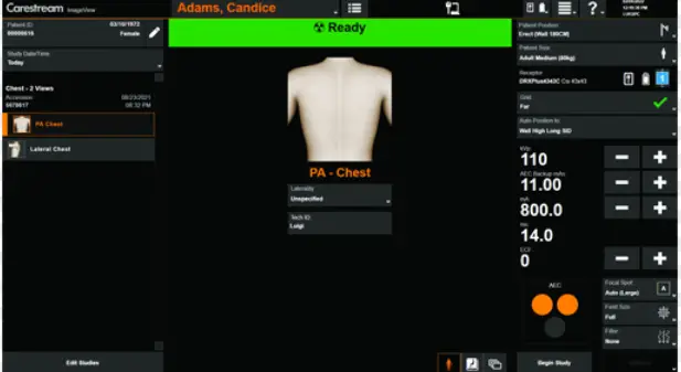Carestream-ImageView-Patient-Positioning-Software-product