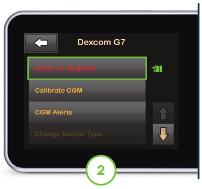 X2 Insulin Pump Dexcom - overview 2