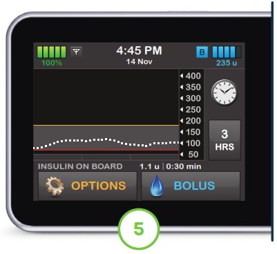 X2 Insulin Pump Dexcom - overview 5