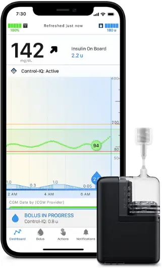 TANDEM-G7-CGM-Mobi-System-with-Dexcom-PRODUCT