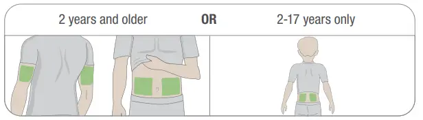 Dexcom-G6-Continuous-Glucose-Monitor-fig-22