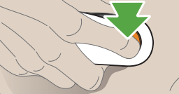 Dexcom-G6-Continuous-Glucose-Monitor-fig-29
