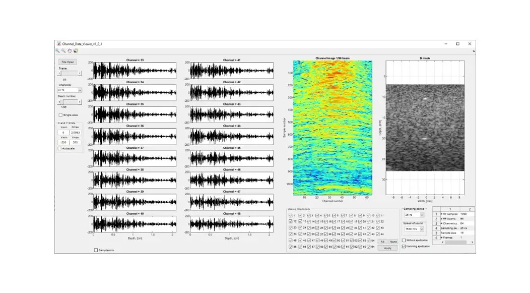 TELEMED Channel Data Viewer - Featured Image